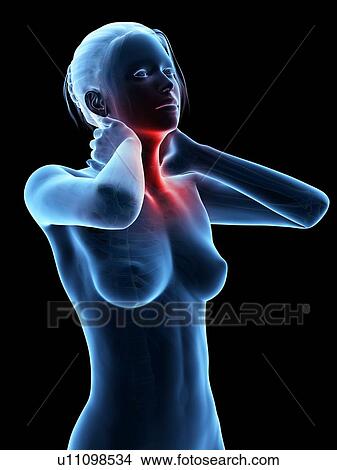 Human neck pain, illustration View Large Illustration Stock Illustration - Human neck pain, illustration. Fotosearch