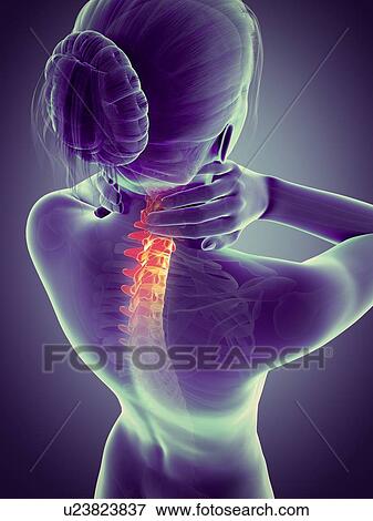 Human neck pain, illustration View Large Illustration Stock Illustration - Human neck pain, illustration. Fotosearch