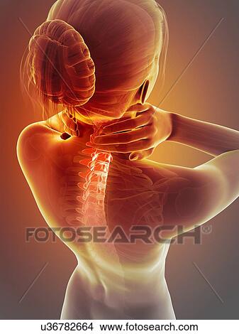Human neck pain, illustration View Large Illustration Stock Illustration - Human neck pain, illustration. Fotosearch