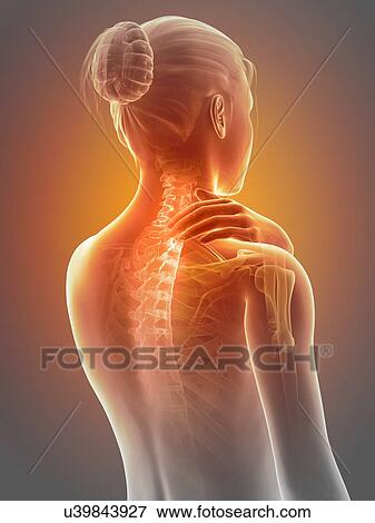 Human neck pain, illustration View Large Illustration Stock Illustration - Human neck pain, illustration. Fotosearch