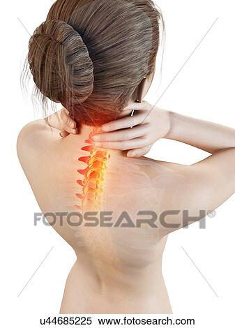Human neck pain, illustration View Large Illustration Stock Illustration - Human neck pain, illustration. Fotosearch