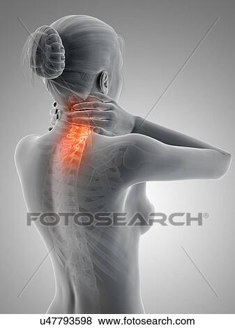 Stock Illustration - Human neck pain, illustration. Fotosearch