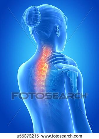 Human neck pain, illustration View Large Illustration Stock Illustration - Human neck pain, illustration. Fotosearch