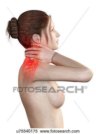 Stock Illustration - Human neck pain, illustration. Fotosearch