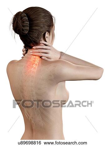 Stock Illustration - Human neck pain, illustration. Fotosearch