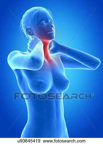 Human neck pain, illustration View Large Illustration Stock Illustration - Human neck pain, illustration. Fotosearch