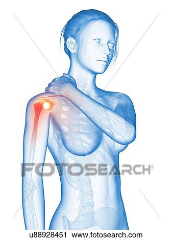 Human shoulder pain, illustration View Large Illustration Clip Art - Human shoulder pain, illustration. Fotosearch