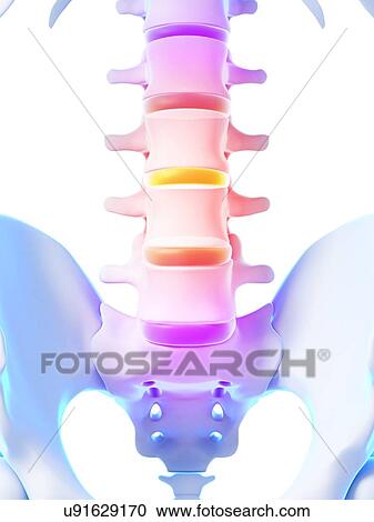 Clipart - Human spinal discs, illustration. Fotosearch