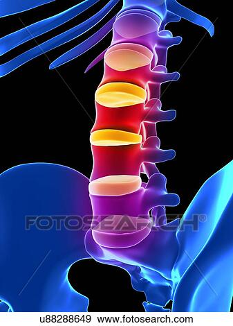 Stock Illustration - Human spinal discs, illustration. Fotosearch