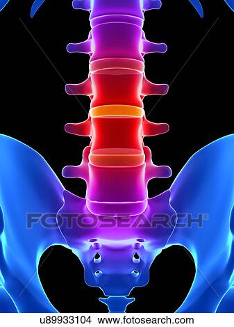 Stock Illustration - Human spinal discs, illustration. Fotosearch