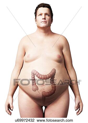 Large intestine of overweight man View Large Illustration Drawing - Large intestine of overweight man. Fotosearch