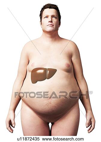 Stock Illustration - Liver of overweight man, illustration. Fotosearch