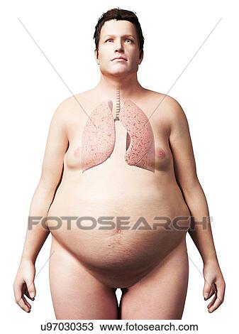 Lungs of an overweight man, illustration View Large Illustration Drawing - Lungs of an overweight man, illustration. Fotosearch
