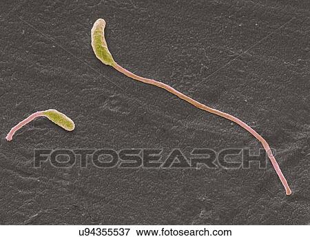 Clostridium phytofermentans, SEM View Large Illustration Stock Illustration - Clostridium phytofermentans, SEM. Fotosearch