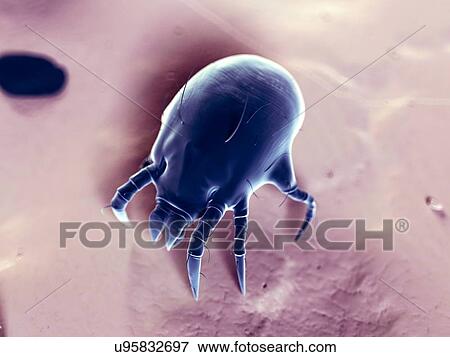 Stock Illustration - Dust mite, illustration. Fotosearch