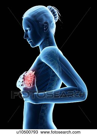 Drawing - Female breast examination, illustration. Fotosearch