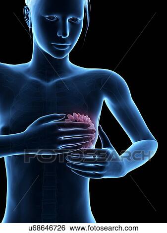 Stock Illustration - Female breast examination, illustration. Fotosearch
