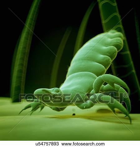 Drawing - Head louse, illustration. Fotosearch