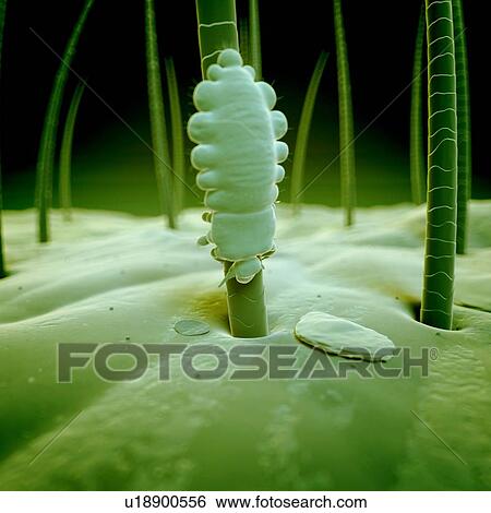 Head louse, illustration View Large Illustration Stock Illustration - Head louse, illustration. Fotosearch