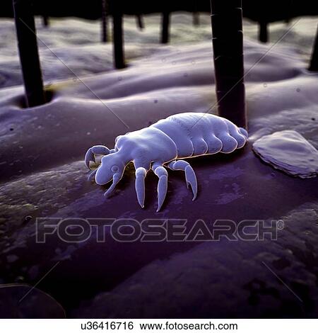 Stock Illustration - Head louse, illustration. Fotosearch