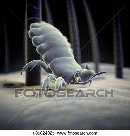 Head louse, illustration View Large Illustration Stock Illustration - Head louse, illustration. Fotosearch