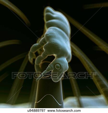 Head louse, illustration View Large Illustration Stock Illustration - Head louse, illustration. Fotosearch