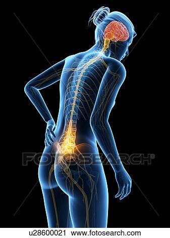 Clip Art - Human back pain, illustration. Fotosearch