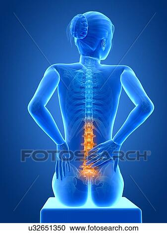 Human back pain, illustration View Large Illustration Clipart - Human back pain, illustration. Fotosearch