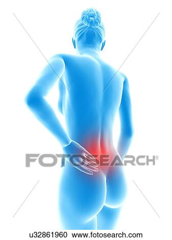 Clipart - Human back pain, illustration. Fotosearch
