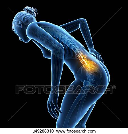 Human back pain, illustration View Large Illustration Clipart - Human back pain, illustration. Fotosearch