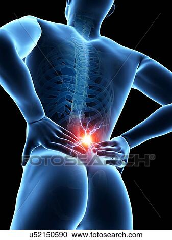 Human back pain, illustration View Large Illustration Clipart - Human back pain, illustration. Fotosearch