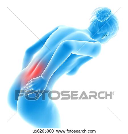 Human back pain, illustration View Large Illustration Clipart - Human back pain, illustration. Fotosearch