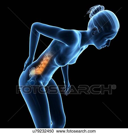 Human back pain, illustration View Large Illustration Clipart - Human back pain, illustration. Fotosearch
