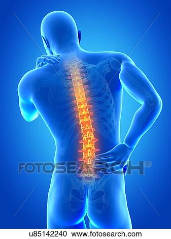 Human back pain, illustration View Large Illustration Clipart - Human back pain, illustration. Fotosearch