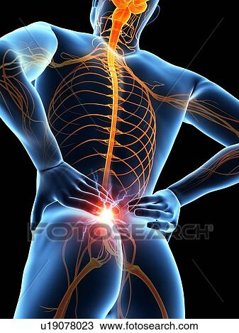 Drawing - Human back pain, illustration. Fotosearch