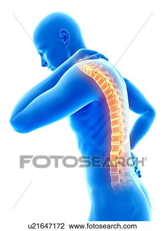 Human back pain, illustration View Large Illustration Drawing - Human back pain, illustration. Fotosearch