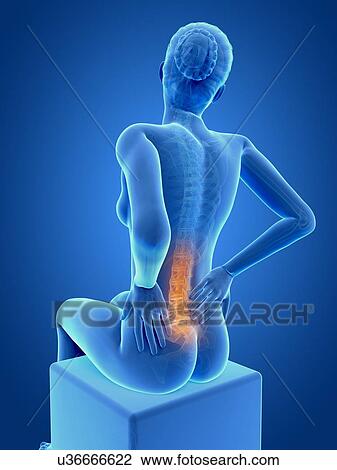Human back pain, illustration View Large Illustration Drawing - Human back pain, illustration. Fotosearch
