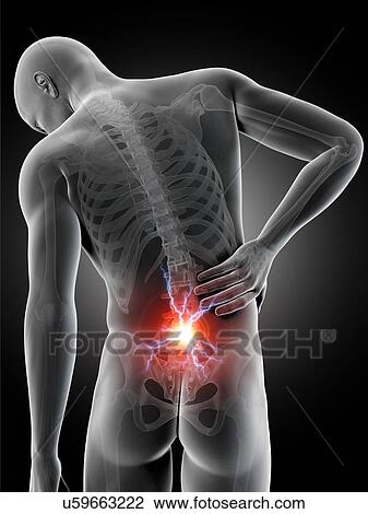 Human back pain, illustration View Large Illustration Drawing - Human back pain, illustration. Fotosearch