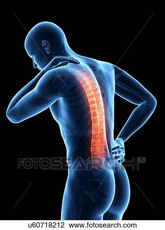 Human back pain, illustration View Large Illustration Drawing - Human back pain, illustration. Fotosearch