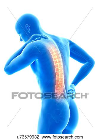 Human back pain, illustration View Large Illustration Drawing - Human back pain, illustration. Fotosearch