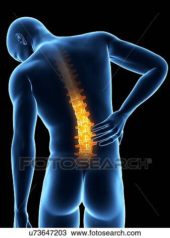 Human back pain, illustration View Large Illustration Drawing - Human back pain, illustration. Fotosearch