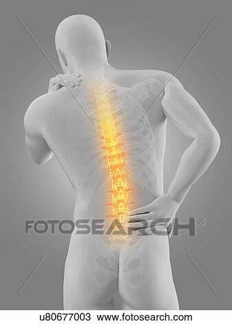 Human back pain, illustration View Large Illustration Drawing - Human back pain, illustration. Fotosearch