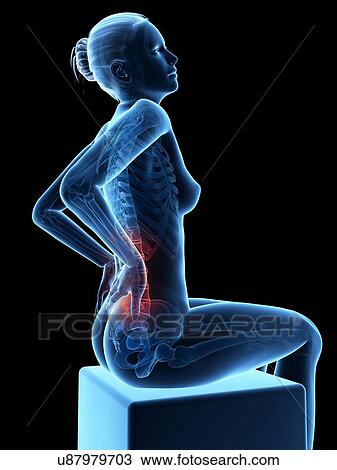 Drawing - Human back pain, illustration. Fotosearch