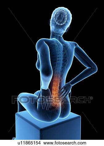Human back pain, illustration View Large Illustration Stock Illustration - Human back pain, illustration. Fotosearch