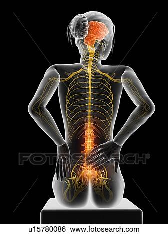 Stock Illustration - Human back pain, illustration. Fotosearch