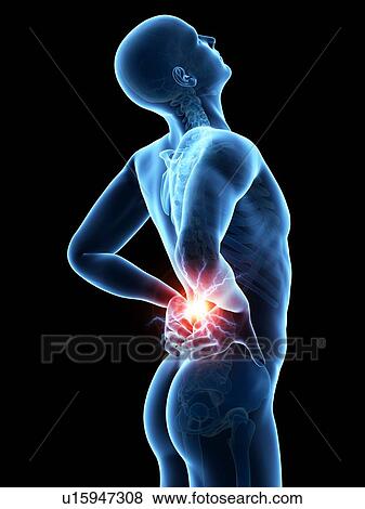 Stock Illustration - Human back pain, illustration. Fotosearch