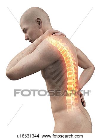 Stock Illustration - Human back pain, illustration. Fotosearch