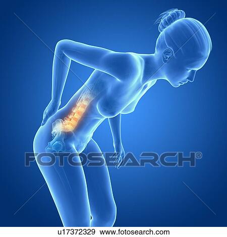 Stock Illustration - Human back pain, illustration. Fotosearch