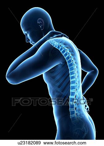 Human back pain, illustration View Large Illustration Stock Illustration - Human back pain, illustration. Fotosearch