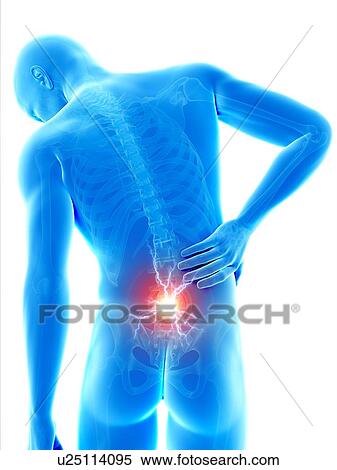 Human back pain, illustration View Large Illustration Stock Illustration - Human back pain, illustration. Fotosearch